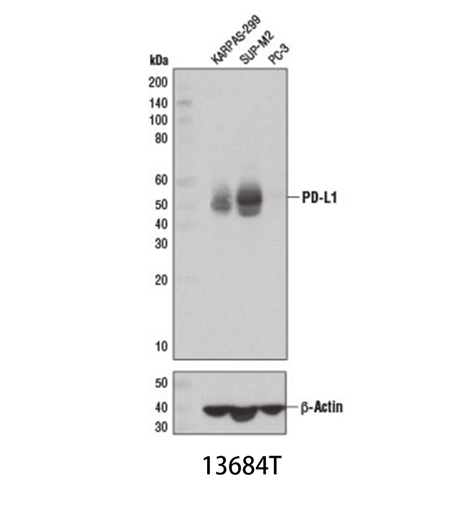 PD-L1 (E1L3N) XP Rabbit mAb