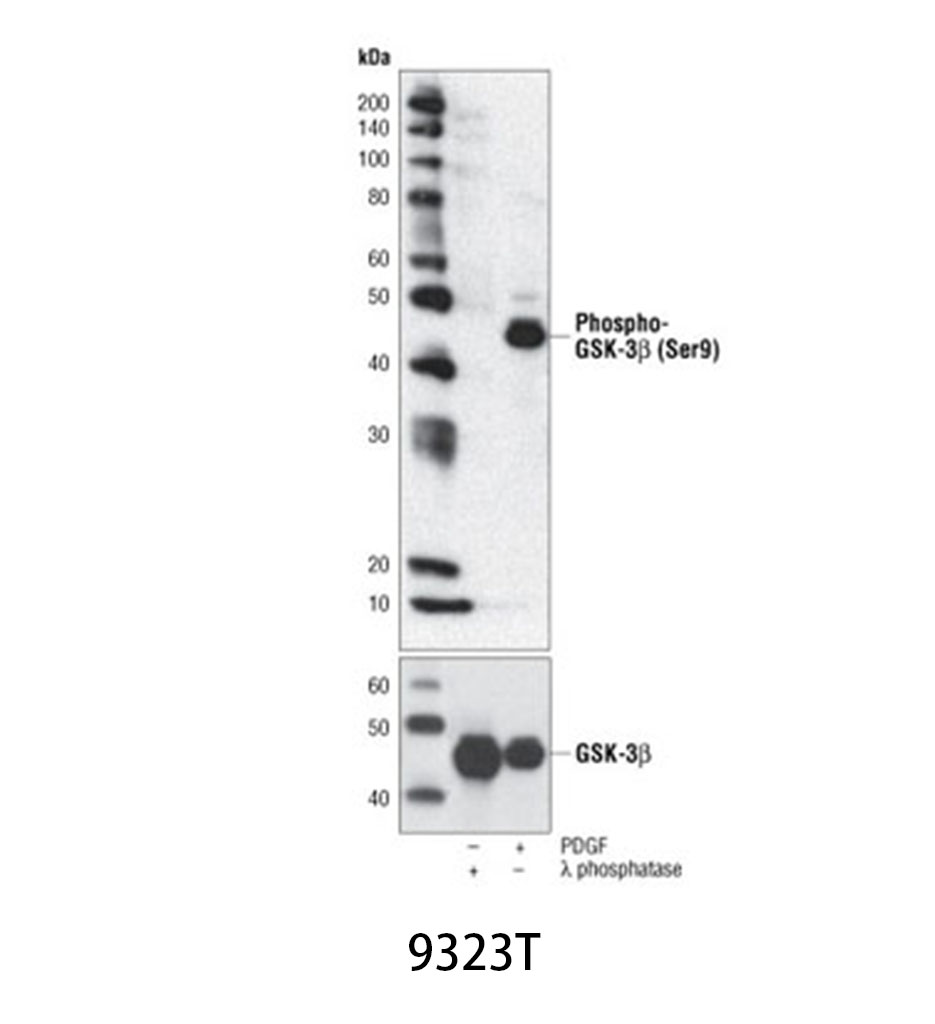 Phospho-GSK-3β (Ser9) (5B3) Rabbit mAb