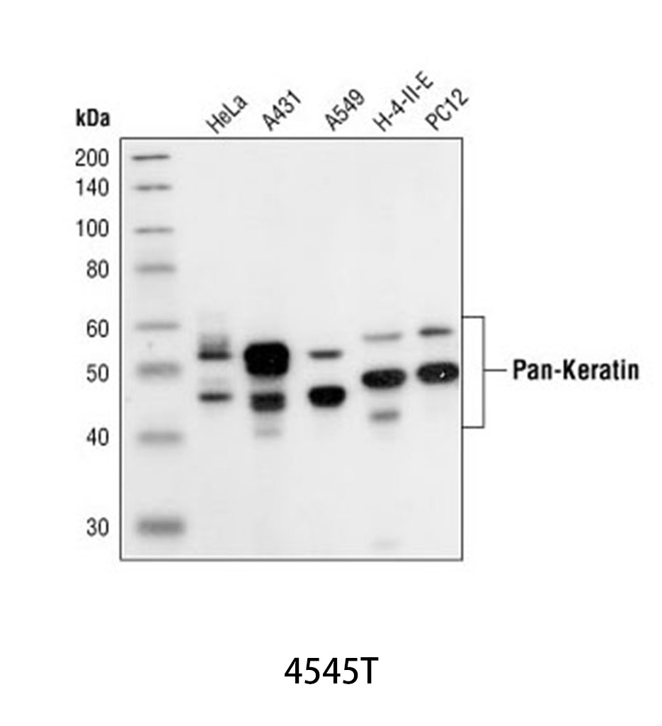 Pan-Keratin (C11) Mouse mAb