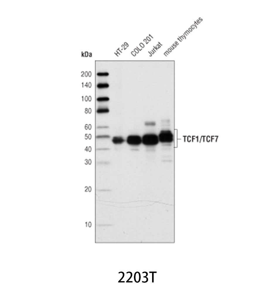 TCF1/TCF7 (C63D9) Rabbit mAb