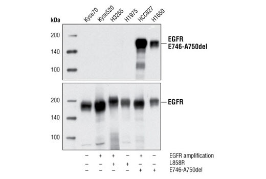 EGF Receptor (E746-A750del Specific) (D6B6) XP Rabbit mAb