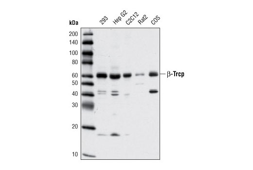 β-TrCP (D13F10) Rabbit mAb