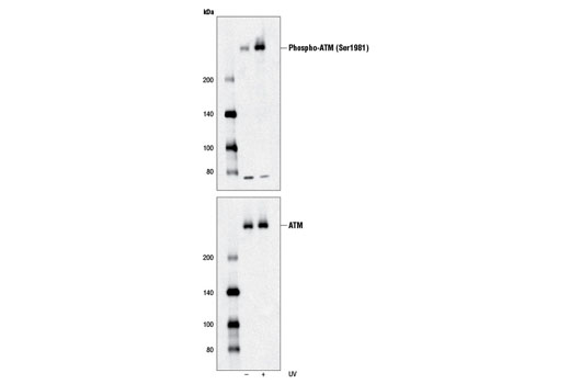 Phospho-ATM (Ser1981) (D6H9) Rabbit mAb