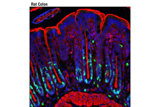 Ki-67 (D3B5) Rabbit mAb (Alexa Fluor 488 Conjugate)