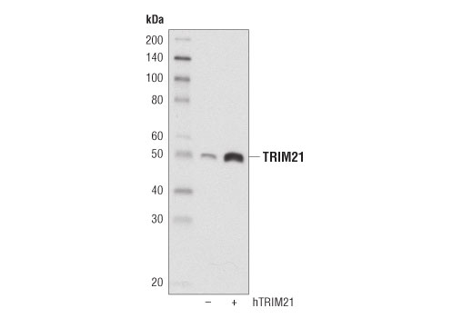 TRIM21 (D1O1D) Rabbit mAb