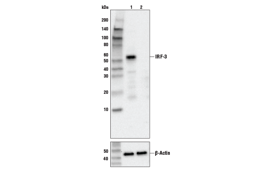 Human-Reactive STING Pathway Antibody Sampler Kit