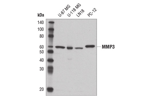 MMP-3 (D7F5B) Rabbit mAb