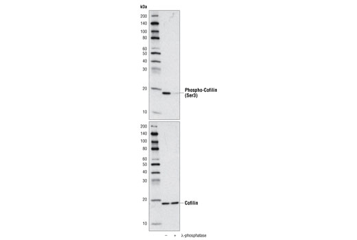 Phospho-Cofilin (Ser3) (77G2) Rabbit mAb
