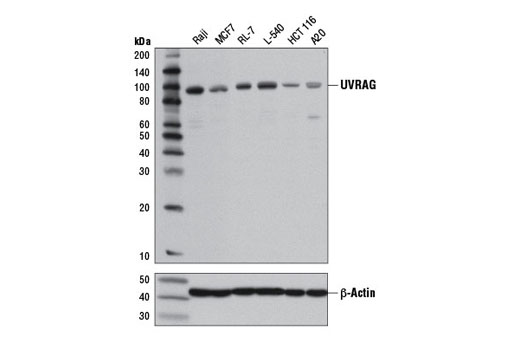 Autophagy Vesicle Nucleation Antibody Sampler Kit