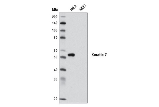 Keratin 7 (D1E4) XP Rabbit mAb