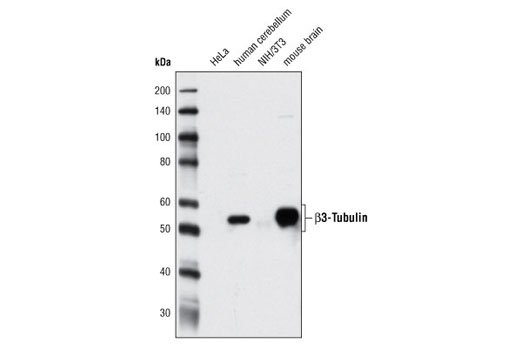 β3-Tubulin (D71G9) XP Rabbit mAb