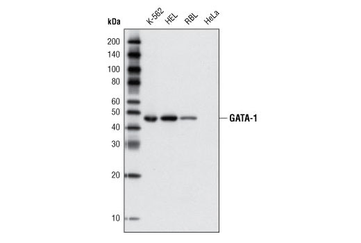 GATA-1 (D52H6) XP Rabbit mAb