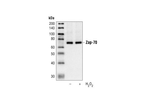Zap-70 (99F2) Rabbit mAb