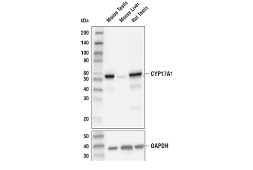 CYP17A1 (E6A7G) XP Rabbit mAb