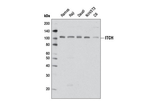 ITCH (D8Q6D) Rabbit mAb