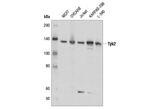 Tyk2 (D4I5T) Rabbit mAb
