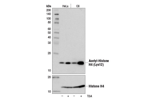 Acetyl-Histone H4 Antibody Sampler Kit
