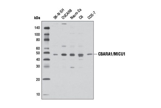 CBARA1/MICU1 (D4P8Q) Rabbit mAb