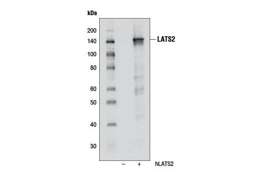 LATS2 (D83D6) Rabbit mAb
