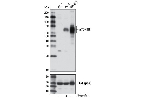 p75NTR (D4B3) XP Rabbit mAb
