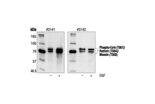 Phospho-Ezrin (Thr567)/Radixin (Thr564)/Moesin (Thr558) Antibody