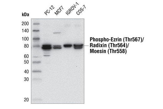 Phospho-Ezrin (Thr567)/Radixin (Thr564)/Moesin (Thr558) (48G2) Rabbit mAb