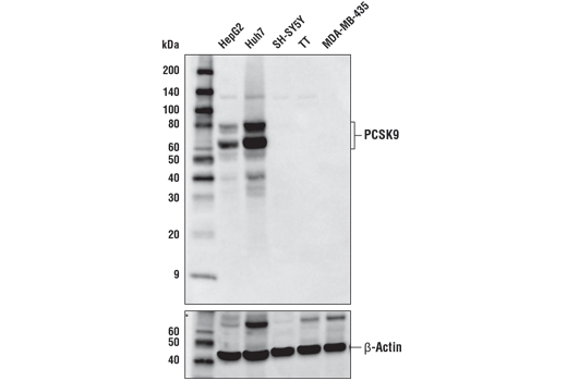 PCSK9 (D5K4S) Rabbit mAb
