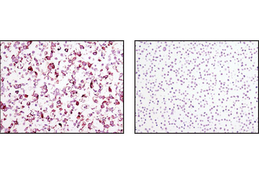 StemLight Pluripotency Surface Marker Antibody Kit