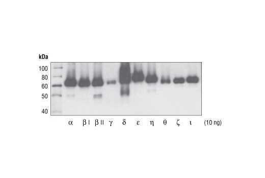 Phospho-PKC (pan) (zeta Thr410) (190D10) Rabbit mAb