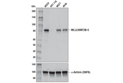 MLL2/KMT2B (D6X2E) Rabbit mAb (Carboxy-terminal Antigen)