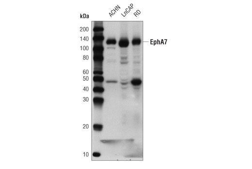 EphA7 (D1C3K) Rabbit mAb