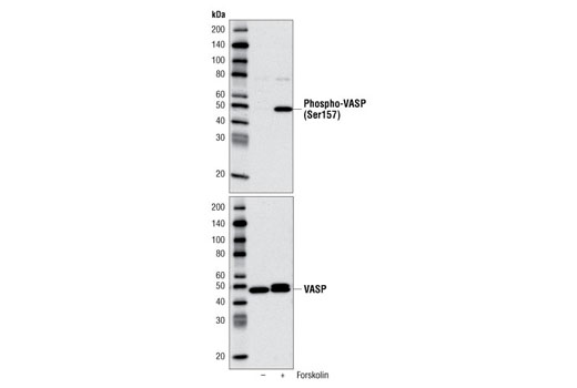 Actin Reorganization Antibody Sampler Kit