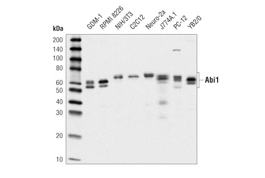 Abi1 (D3G6C) Rabbit mAb