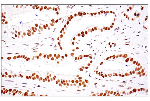 SETD2 (E4W8Q) Rabbit mAb (IHC Formulated)