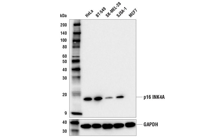 p16 INK4A (E6N8P) Rabbit mAb